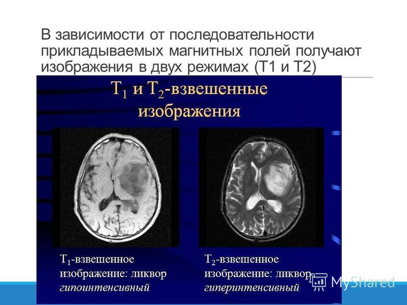 Т1 и т2 взвешенные изображения